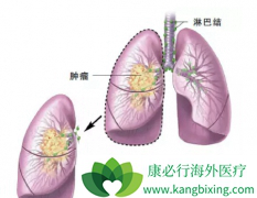 ��Сϸ���ΰ����Ӱ������Ƴ�Ϊ�о����ȵ�