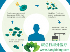 CAR-Tϸ���Ʒ�KYMRIAH����ʱ�����˾޴�ĺ䶯