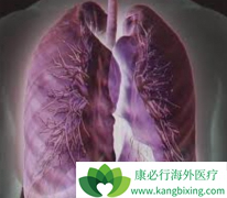 ���ڷΰ�ת�Ƶ�����ͷ������Ϊ�λ�Ƚϼ���