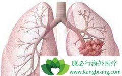 ���ڷ�Сϸ���ΰ���һЩ������֪ʶ