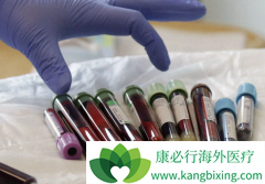 CAR-Tϸ����������ô��չ�����ڵģ���ôȥ����ʹ��CAR-T�Ʒ���