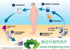 ʲô��CAR-Tϸ�����ƣ�CAR-Tϸ�����Ƶ�Ч����ô����