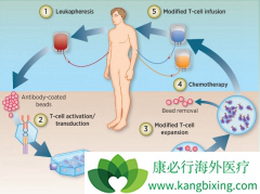 �ڹ�����Ҫ����CAR-Tϸ��������ô�죿����ȥ������CAR-T�Ʒ���