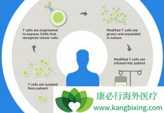 ��ô����ȥ��������CAR-Tϸ�����ƣ��й���CAR-T�Ʒ���