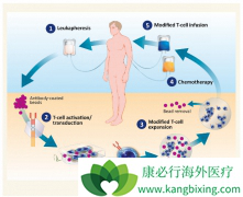 ��ô����ȥ��������CAR-T���ƣ�������CAR-T�Ʒ�����