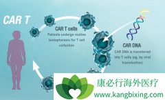 ���ڻ�����ȥ��������CAR-T������CAR-T�Ʒ�����Ч����ô����