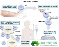 CAR-T�۸񰺹����������̵����������ϸ�