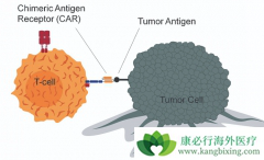 ���CAR-T�Ʒ�����ν��а�֢���Ƶ�