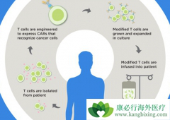 CAR-T�����Ĳ�����Ӧ����Щ��������