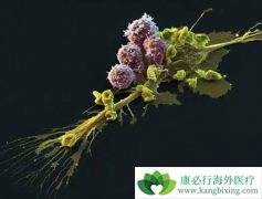 CAR-Tϸ���Ʒ�Kymriah�����ܰ���Ч�����