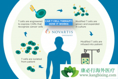 ������CAR-Tϸ�����Ʒ�������Щ���ƣ�CAR-T�Ʒ�Ч����ô����