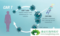 CAR-Tϸ�����Ƶ���ʵ����Ч����ô����������Խ���CAR-T���ƣ�