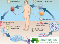 CAR-T��ע���и���������ô����CAR-T�ĸ�����