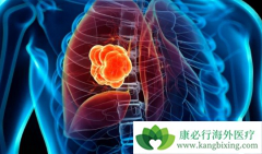 �����ʺ������ʶ��ܸߵķΰ��ᴫȾ��