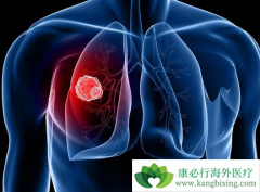 ��Сϸ���ΰ�������Ӧ����ȡ�ۺ�����廯�������ϵ�ԭ��