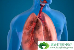 �ΰ�������ô�������ӳ����ߵ�����ʱ��