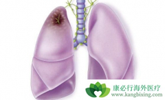 ���߳��ַΰ���Ѫ֢״ʱӦ������ҽ