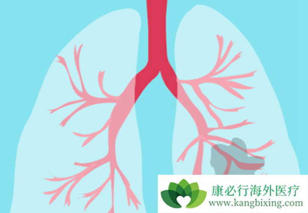 肺癌放疗 肺癌放疗