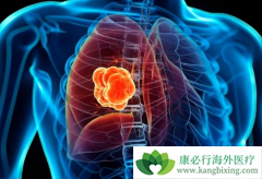 �ΰ���ת��֢״����Щ��ת�ƺ��߻��ܻ��ã�