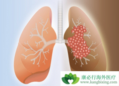 �ΰ�������֢״����Щ���ΰ����ڻ��ܻ��ã�