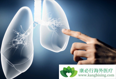 �ΰ�������֢״�ͷΰ����������Ʒ�����ʲô��