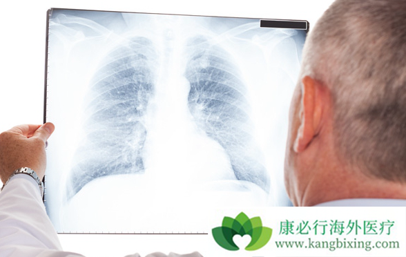 肺癌治疗 肺癌治疗