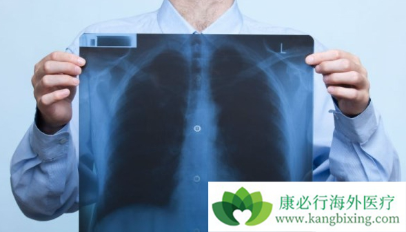 肺癌晚期 肺癌晚期