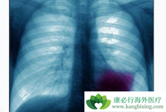 �ΰ��������ƿɴ�󽵵����ڷΰ����ߵ�ʹ��