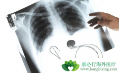 ���������Ƿ�Сϸ���ΰ����ڻ�����Ч�����Ʒ���