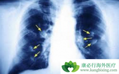 �ΰ����κ��𣿷ΰ����������Ʒ�������Щ��