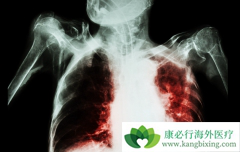 �ΰ����������κ������Ʒΰ���������Щ��