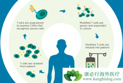 CAR-Tϸ�����Ʊ���Ϊ�����Ǳ���İ�֢���Ʒ���