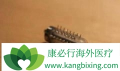 ����ҽ���¼����ô�����Һ��Ϊ��ȥʽ��