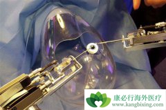 ����ҽ�����������˿ɽ��������������ս�����