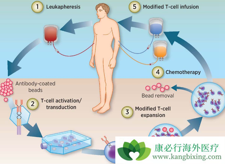 CAR-T