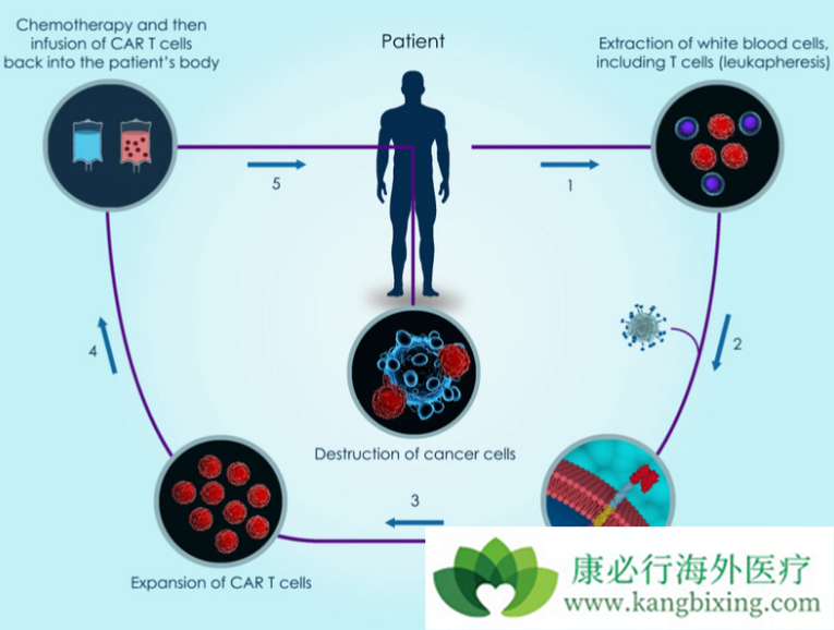 CAR-T