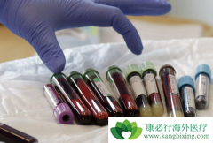 CAR-Tϸ�����Ʒ�������ѪҺ�������Ƶõ��˺ܺõ���Ч