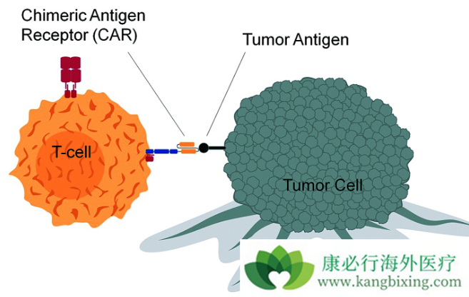 CAR-T