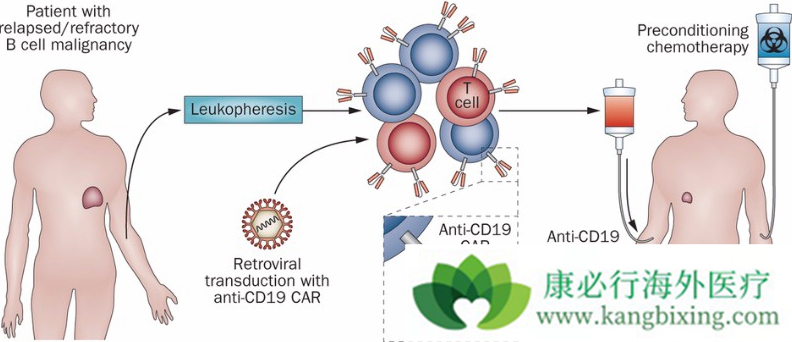 CAR-T