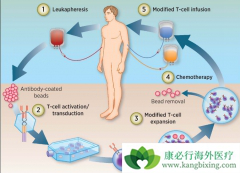 �׸�CAR-Tϸ�����Ʒ���KYMRIAH����ѪҺ������������Ч