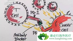 NKϸ������PD-1���Ƽ��ܴ����������Ʒ�����Ч��