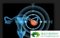 ��������(Olaparib)Ϊ�����ѳ������ߴ�������ϣ��