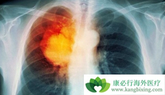 ���ڷΰ�ҩ���ϣ���ᣨAZD9291)��ҩ����������