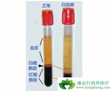 ��Ѫ������������Щ����Ѫ������ô����