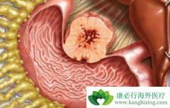 ��Щθ��������������������Ҫ������/�������Ḩ������