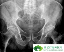 ���϶෢�Թ�������֢״����������ô����