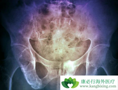 ʲô�Ƕ෢����������ο��෢�����������س̶�