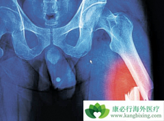 ������������Ƥ�ʼ��ضԶ෢���������ߵĸ�����