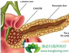 �������ٰ��������������Ĺؼ�ȡ����ʲô