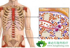 ʲô�Ƕ෢�Թ����������������ƴ˲�����Чҩ����